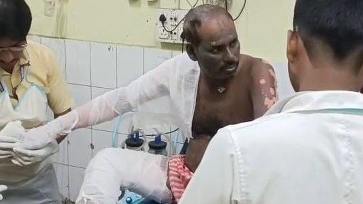 धनबाद के पाथरडीह कोल वाशरी में वेल्डिंग मशीन हादसे की प्रतीकात्मक तस्वीर