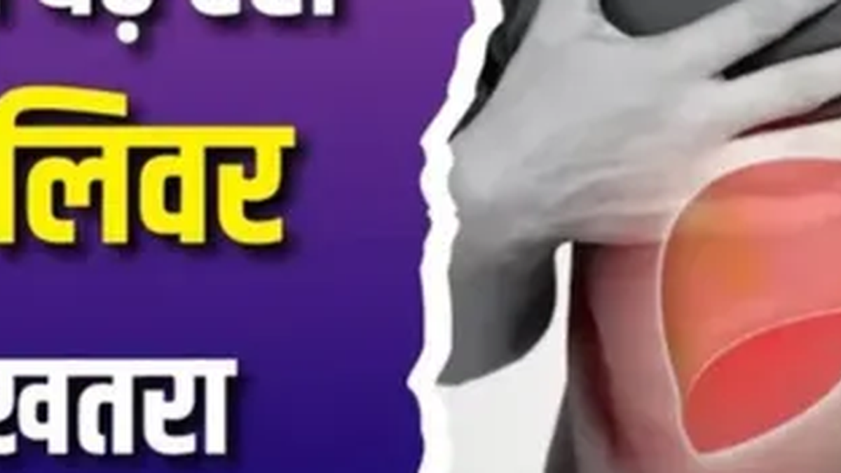 रांची में फैटी लीवर जांच अभियान के लिए तैयार मोबाइल चिकित्सा वाहन